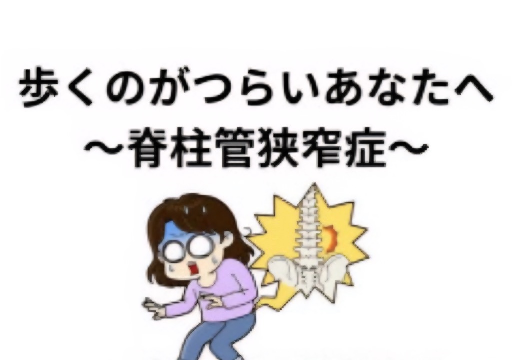 脊柱管狭窄症とは⁉︎
